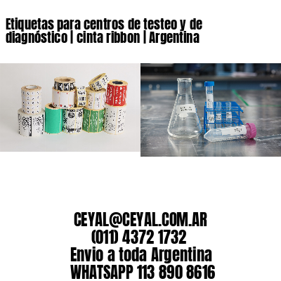 Etiquetas para centros de testeo y de diagnóstico | cinta ribbon | Argentina