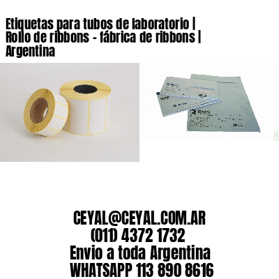 Etiquetas para tubos de laboratorio | Rollo de ribbons – fábrica de ribbons | Argentina