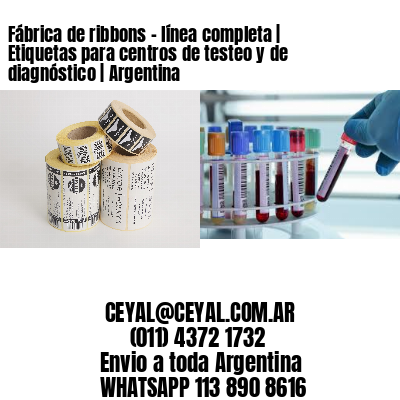 Fábrica de ribbons – línea completa | Etiquetas para centros de testeo y de diagnóstico | Argentina